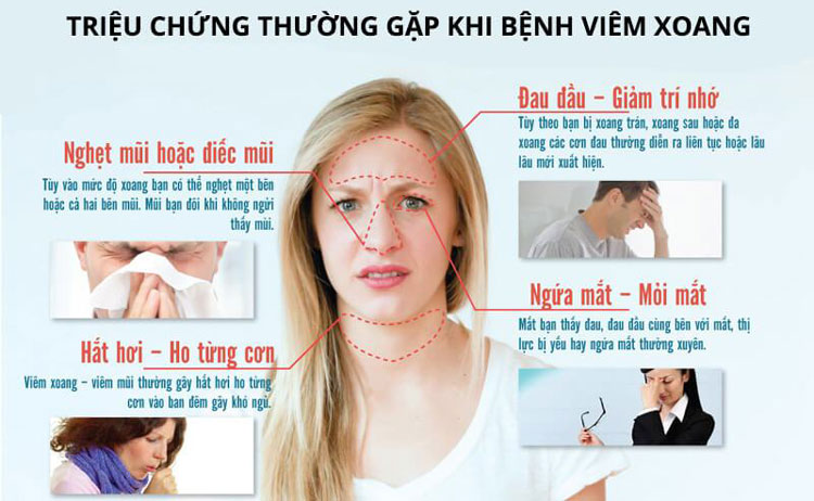 Biến Chứng của Bệnh Viêm Xoang