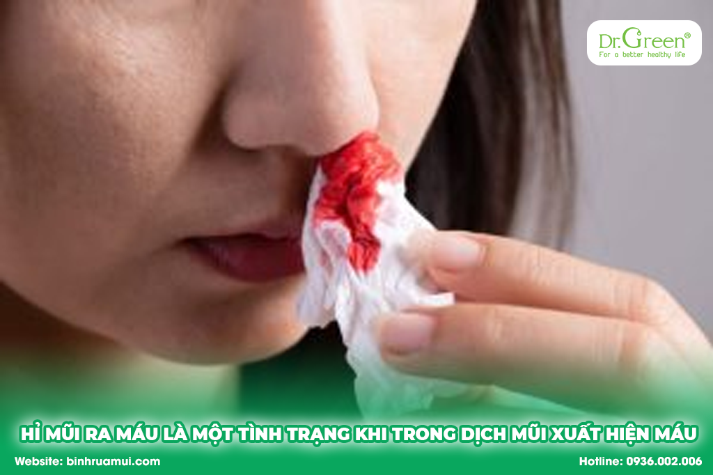 Hỉ mũi ra máu là một tình trạng khi trong dịch mũi xuất hiện máu