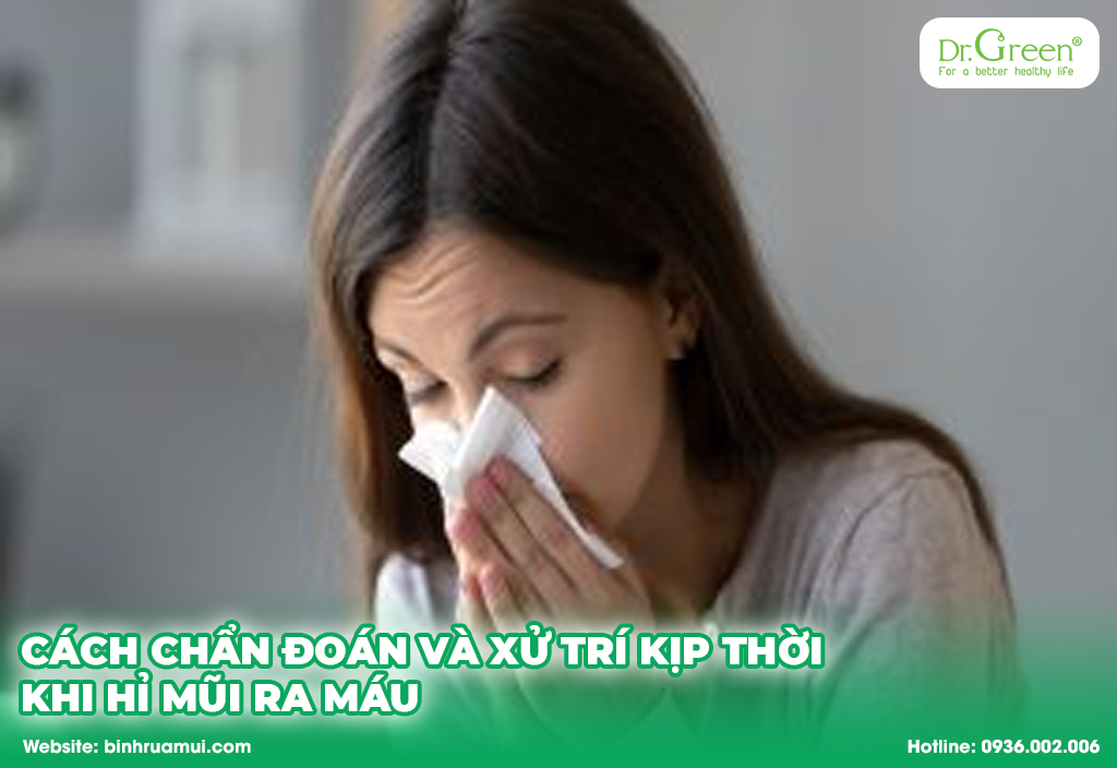 cách chẩn đoán và xử trí kịp thời khi hỉ mũi ra máu