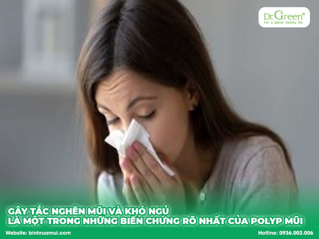 gây tắc nghẽn mũi và khó ngủ là một trong những biến chứng rõ nhất của polyp mũi